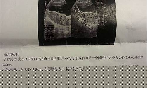 子宫肌瘤是否影响怀孕？