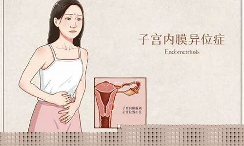 子宫内膜异位症会导致不孕吗？