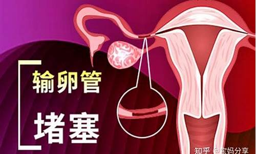 输卵管堵塞会导致不孕吗？