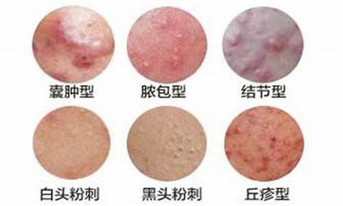 婴儿常见的皮肤问题有哪些？