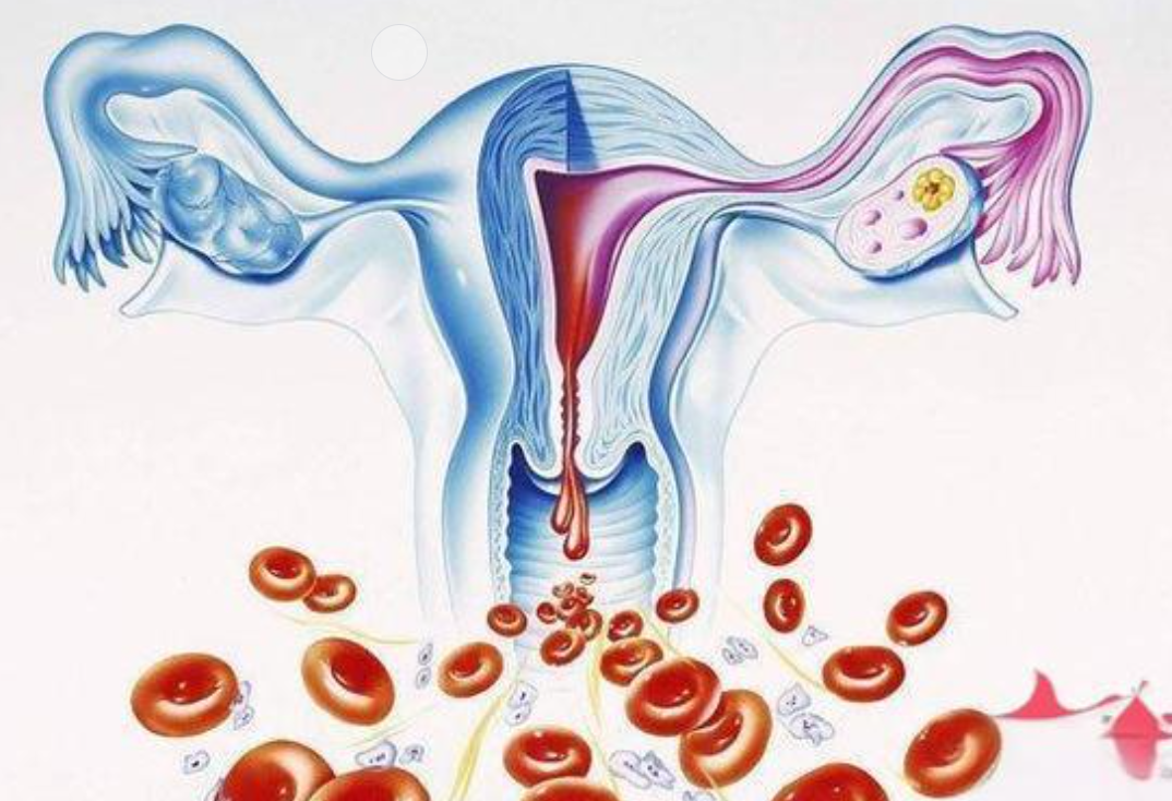 经期出血过多怎么办？