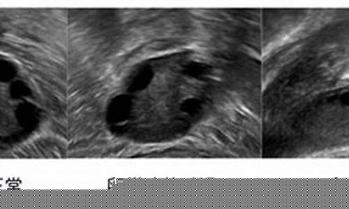 如何检查卵巢功能？