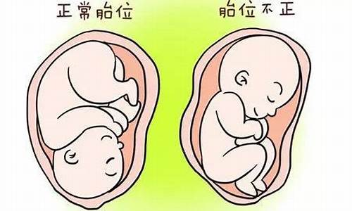 如果胎儿位置不正,如何做准备?