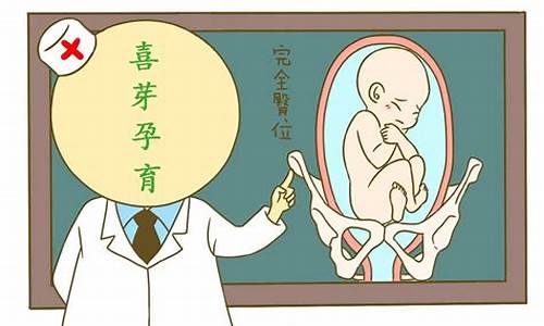 如何选择分娩方式(自然分娩、剖腹产等)?