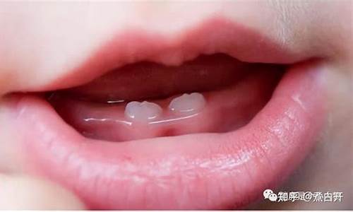 婴儿出牙时会出现哪些症状？