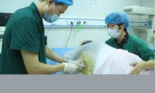 分娩时是否需要特定的服装?