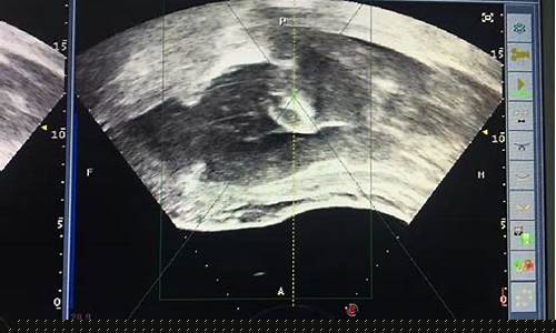 什么时候适合做B超检查？