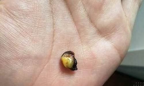 婴儿的脐带脱落时间是多久？