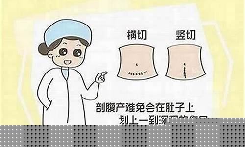 剖腹产的过程是什么样的?