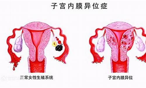 通过手术治疗不孕的风险有哪些？