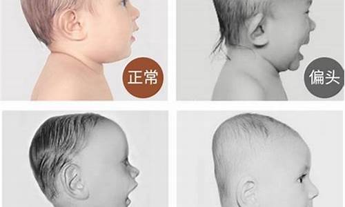 婴儿什么时候开始长头发?