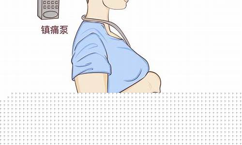 产妇是否可以在分娩时选择是否剖腹产?