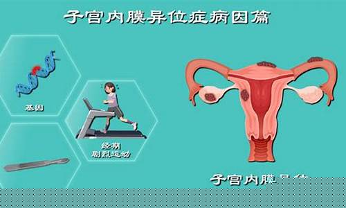 子宫内膜异位症的治疗方法是什么？