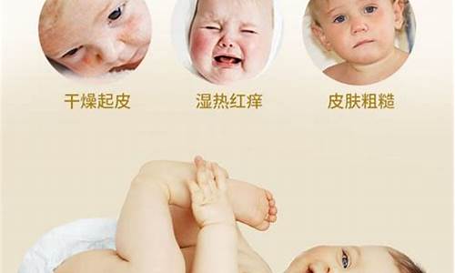 婴儿皮肤干燥怎么办？