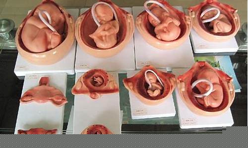 如果分娩过程中发生意外情况,应该如何应对?