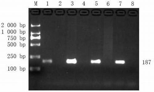 性别偏好对基因检测查宝宝性别的需求有何影响？