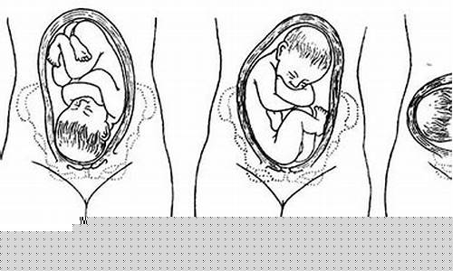 如何判断分娩过程中胎儿是否受到窒息?