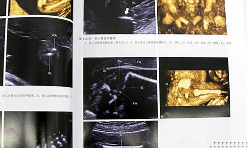 产前检查如何评估胎儿的健康状况？